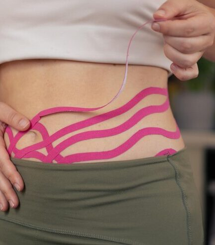 ROZEJŚCIE MIĘŚNIA PROSTEGO BRZUCHA